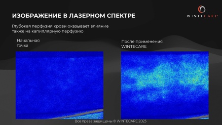 Аппарат для радиочастотной клеточной электротерапии WINTECARE T-Plus