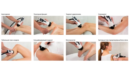 Аппарат ударно-волновой терапии DUOLITH SD1 T-TOP «F-SW Ultra»