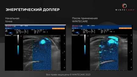 Аппарат для радиочастотной клеточной электротерапии WINTECARE T-Plus