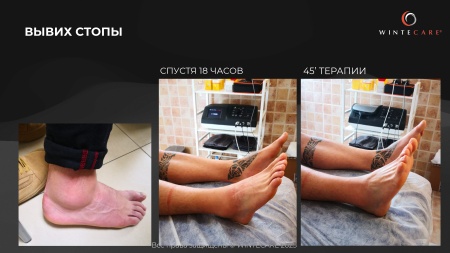 Аппарат для радиочастотной клеточной электротерапии WINTECARE T-Plus
